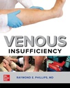 VENOUS INSUFFICIENCY (IE)