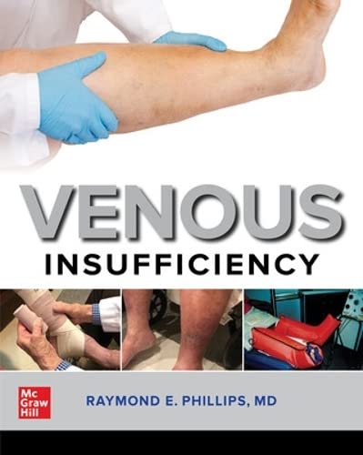 [B9781260469011] VENOUS INSUFFICIENCY (IE)