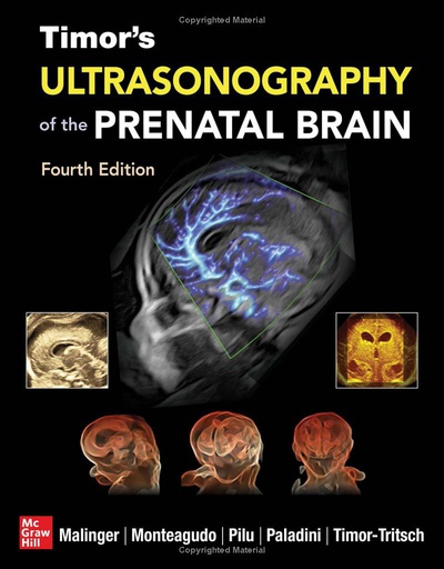 [B9781260136166] ULTRASONOGRAPHY OF THE PRENATAL BRAIN