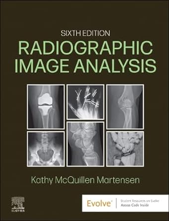 [B9780323930697] Radiographic Image Analysis: 6ed